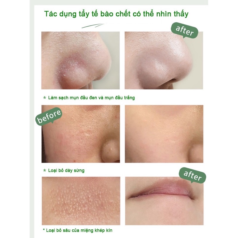 Tẩy tế bào chết Prettyskin 150ml