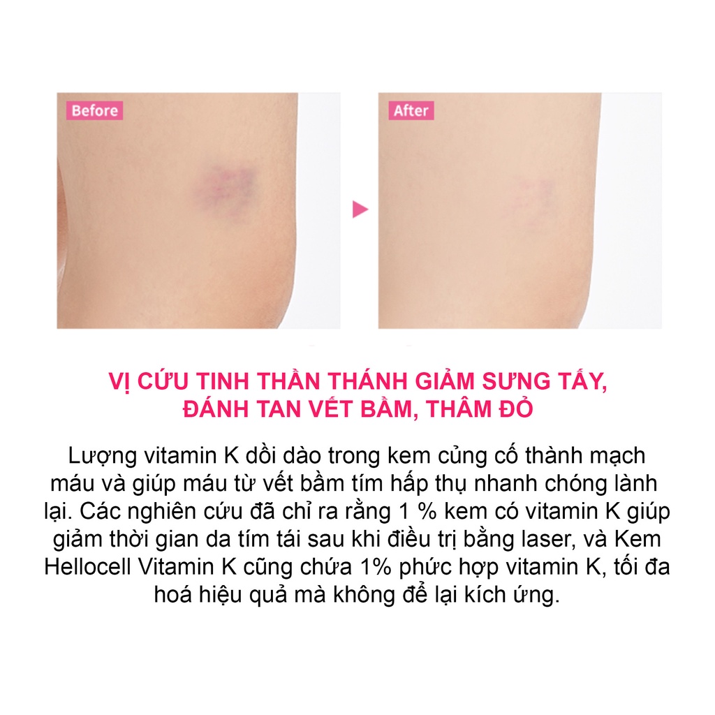 KEM VITAMIN K PHỤC HỒI SAU XÂM LẤN