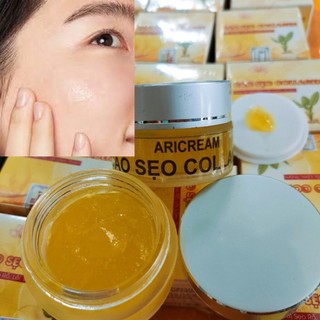 Hàng chuẩn spa : cao liền sẹo collagen lành sẹo rỗ, sẹo lõm, sẹo lồi