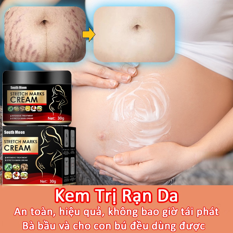 kem trị rạn da Kem chống rạn da 30g kem rạn da bà bầu trước sinh sau sinh cải thiện rạn chống rạn da đùi mông ngực