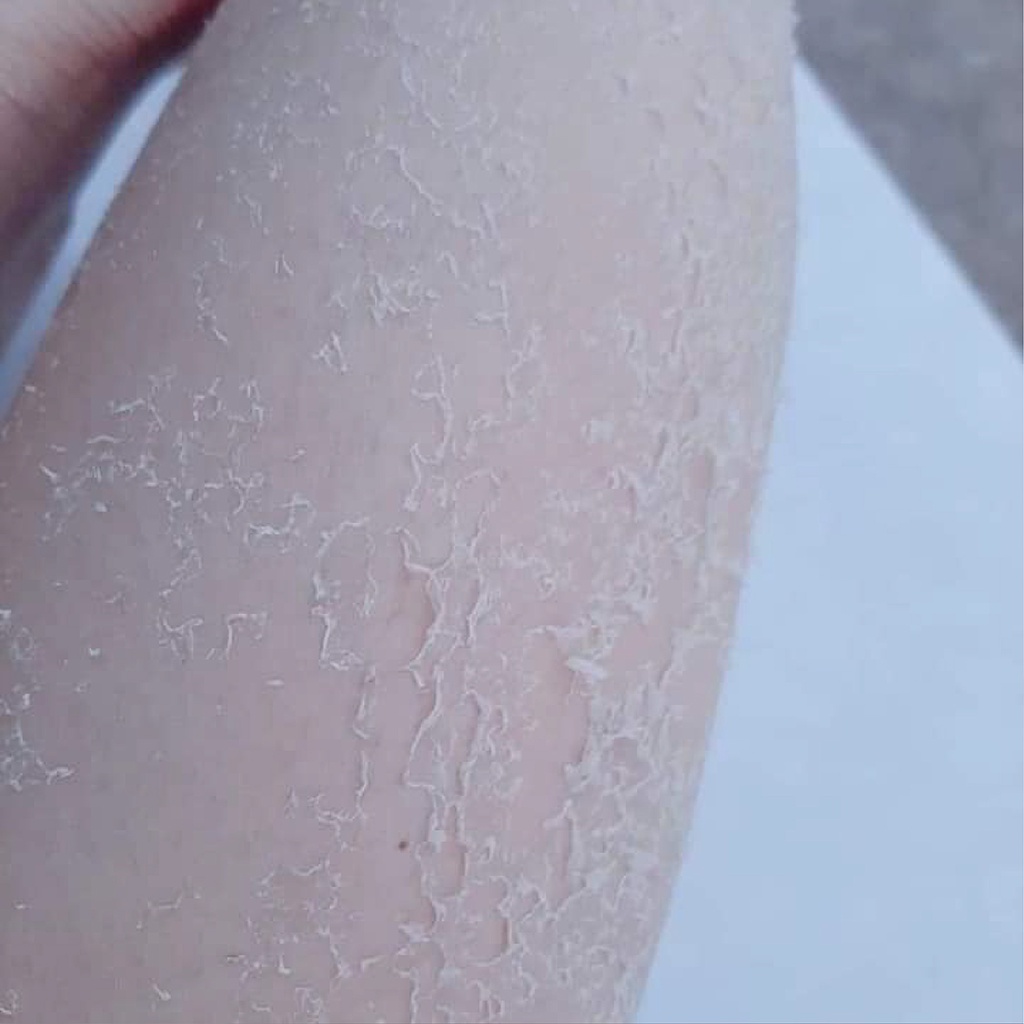 Kem Body Thay Da - Kem body bong da - Tái Tạo Thay Da Sinh Học Phục Hồi Dưỡng Trắng Bong Da Toàn Thân peel retinol