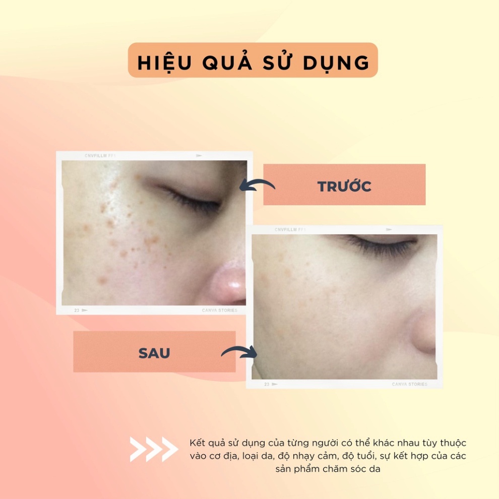 Serum dưỡng trắng TOPCHARM - tái tạo và trẻ hóa da tinh chất vàng, giúp da căng bóng và săn chắc