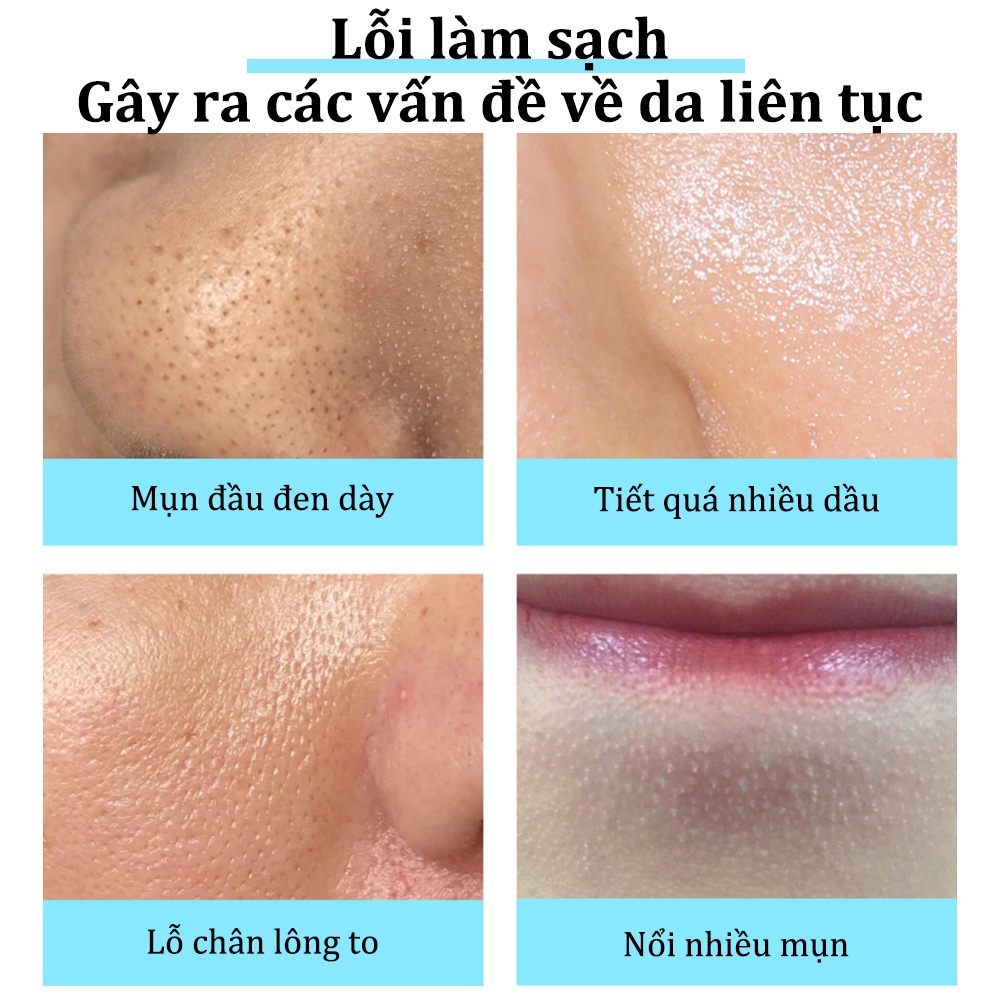 Kem làm trắng da, kem dưỡng ẩm da, mặt nạ làm trắng da, loại bỏ mụn đầu đen, chăm sóc da， Keo Lột Mụn Sâu Tận Gốc Hiệu Q