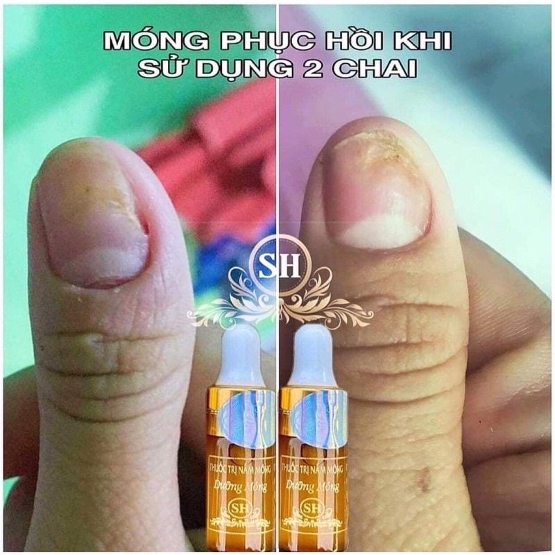 [Chính hãng SH] Serum nấm móng ,bọng, hư khóe móng SH