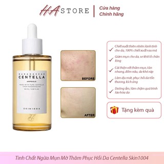 Tinh Chất Rau Má Skin1004 Madagascar Centella Ampoule Serum Ngừa Mụn Mờ Thâm Phục Hồi Da