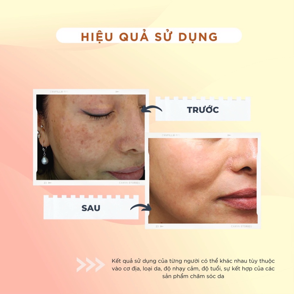 Kem Dưỡng Da Trắng Hồng CHAMIS - Giúp Làm Mờ Vết Thâm, Nám tàn nhang - tuýp 10g