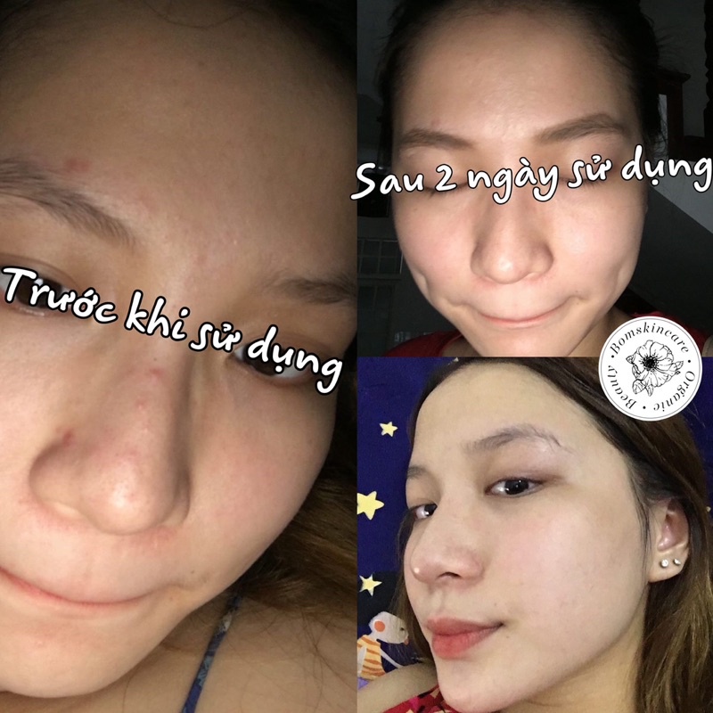 TINH CHẤT CẤP NƯỚC DƯỠNG DA SERUM FRESH