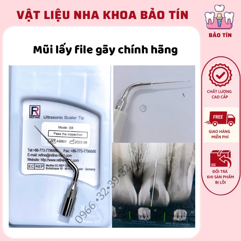 Mũi lấy file gãy trong ống tuỷ răng