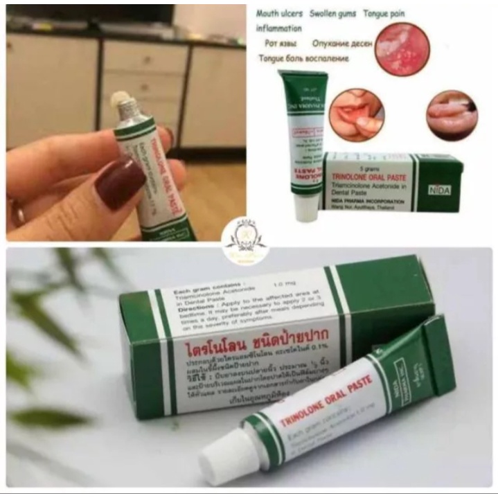 (1 tuýp )kem bôi nhiệt miệng trinolone oral paste 5g Thái Lan