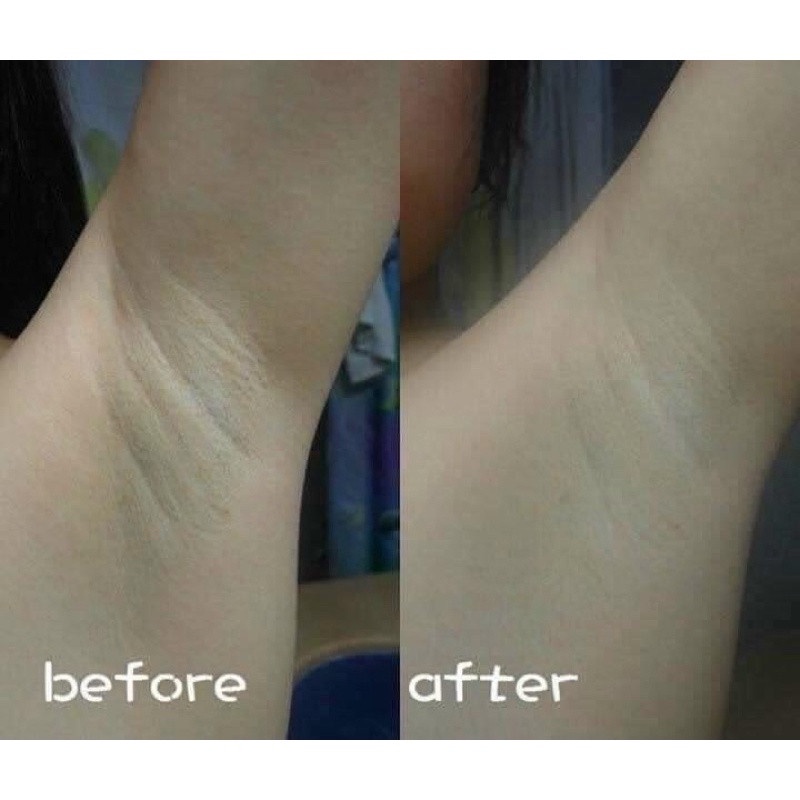 Mờ thâm ISME Whitening giảm thâm mông body nách bẹn đầu gối khuỷu tay bikini nhũ hoa khử mùi hôi