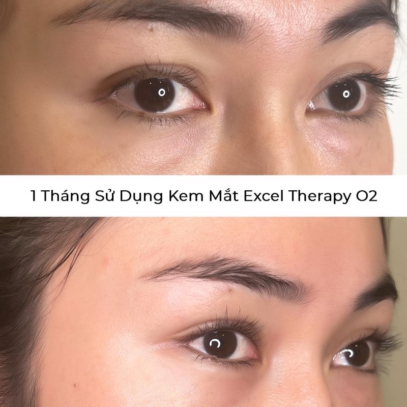 Kem Mắt Oxy Tinh Khiết xóa Quầng Thâm & Bọng Mắt ET O2 Pollution Defense Eye 15ml Contour Germaine De Capuccini