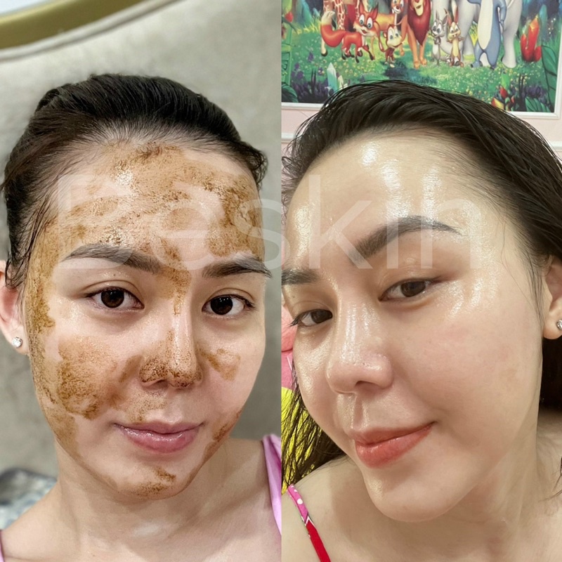 Serum mụn Beskin Herbal Serum