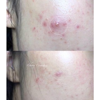 [𝐀𝐔𝐓𝐇𝐄𝐍𝐓𝐈𝐂-Loutu] Kem Dưỡng S.V.R Active