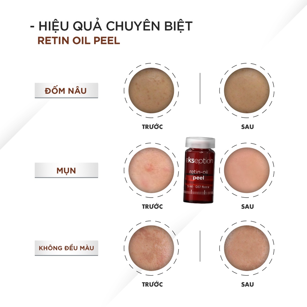 Tinh chất Peel da Ekseption Retin-oil 5ml