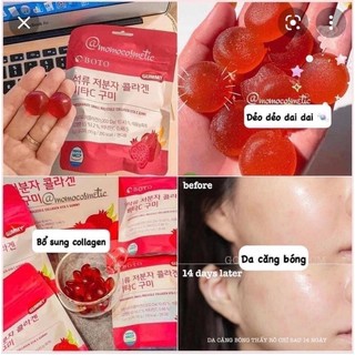 Kẹo Collagen Lựu Boto- Kẹo dẻo Gummy- Collagen vitamin C