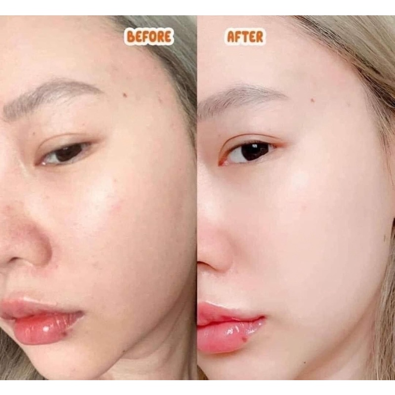 Toner Kim Cương Pretty Skin