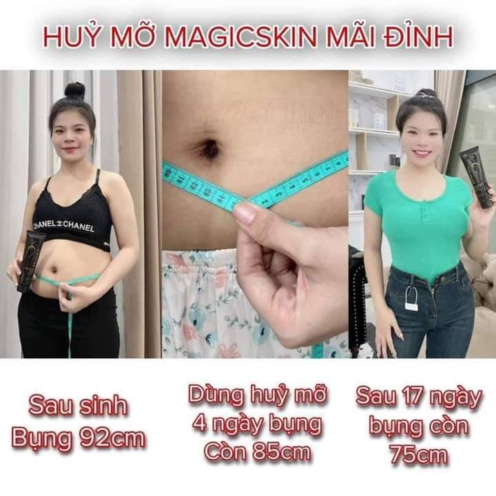 KEM TAN MỠ GỪNG - QUẾ MAGIC SKIN