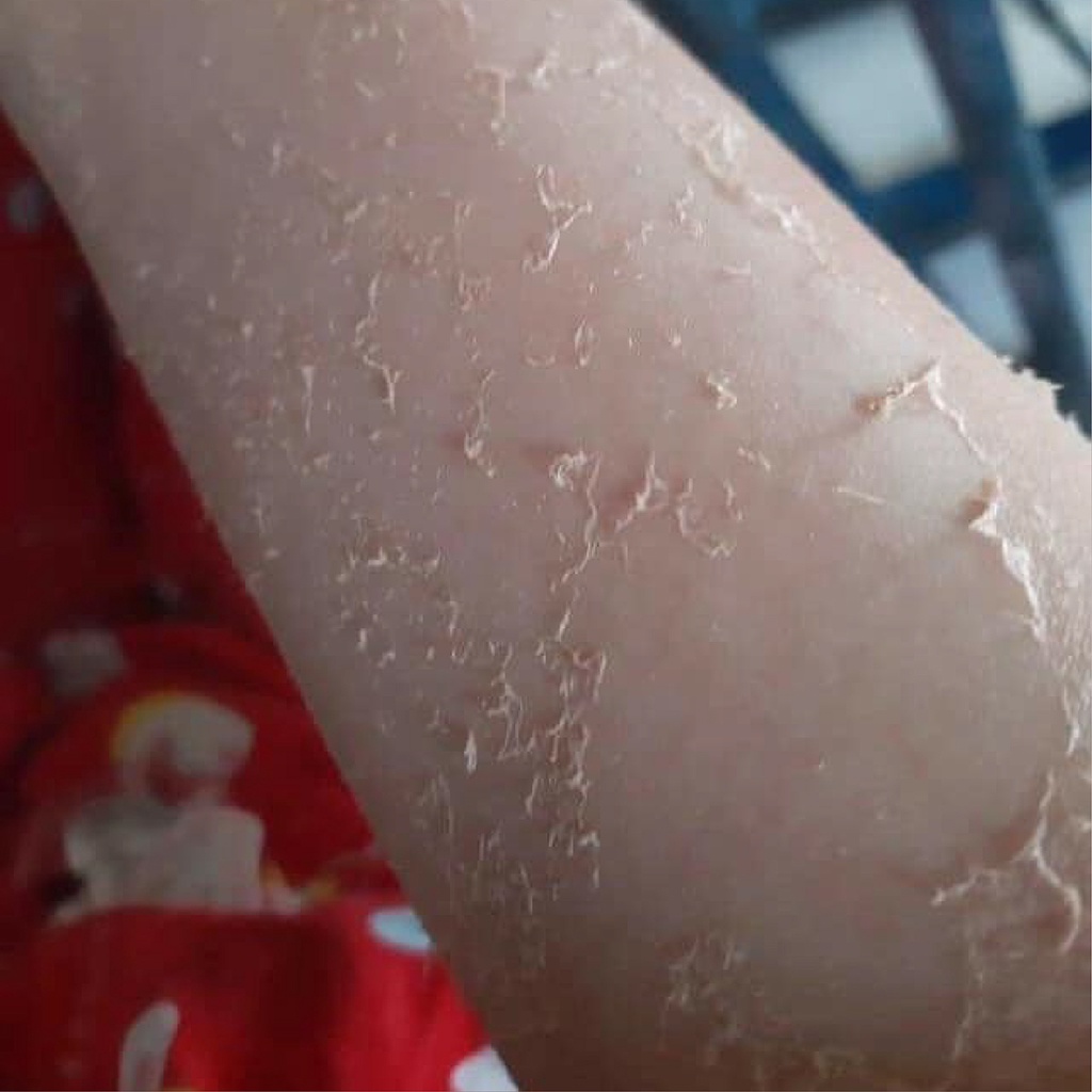 Kem Body Thay Da - Kem body bong da - Tái Tạo Thay Da Sinh Học Phục Hồi Dưỡng Trắng Bong Da Toàn Thân peel retinol