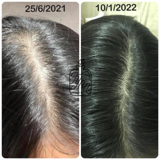 Combo GỘI - XẢ thảo mộc thiên nhiên