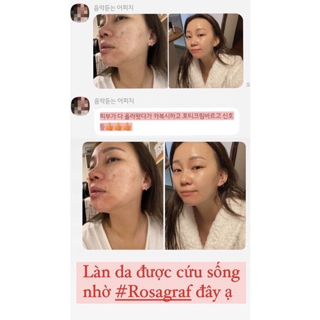 Kem dưỡng ROSAGRAF Forty Plus Up Cream 150ml Bebalance