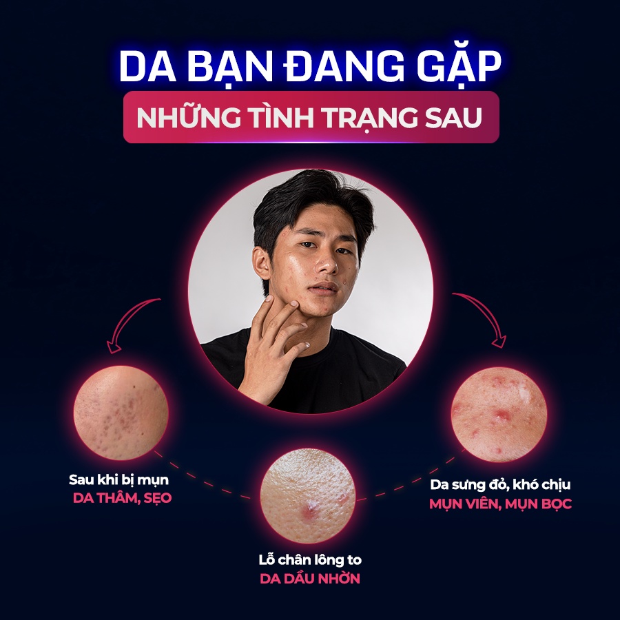 Combo Giảm Mụn Mờ Thâm Dành Cho Nam Giới The Menco Zinc White Acne 10ml và Lightening Serum 30ml