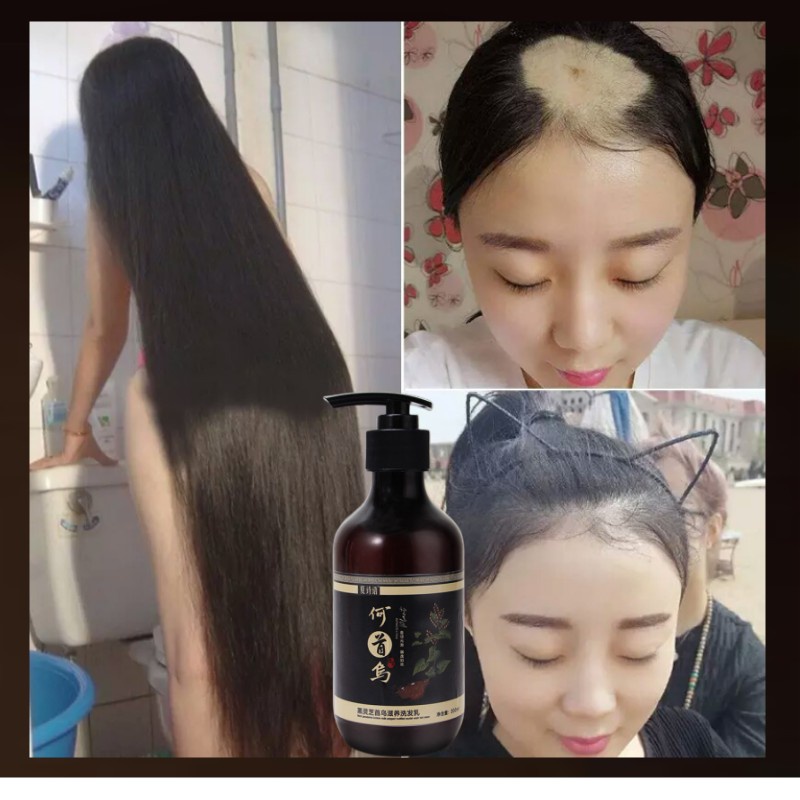 Dầu gọi móc tóc Tóc đen sạch da đầu loại bỏ gàu để ngăn ngừa rụng tóc an toàn nhà máy chăm sóc da da đầu 300ML