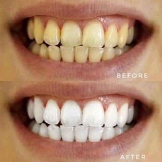 kem đánh răng 93 số 1 Hàn Quốc