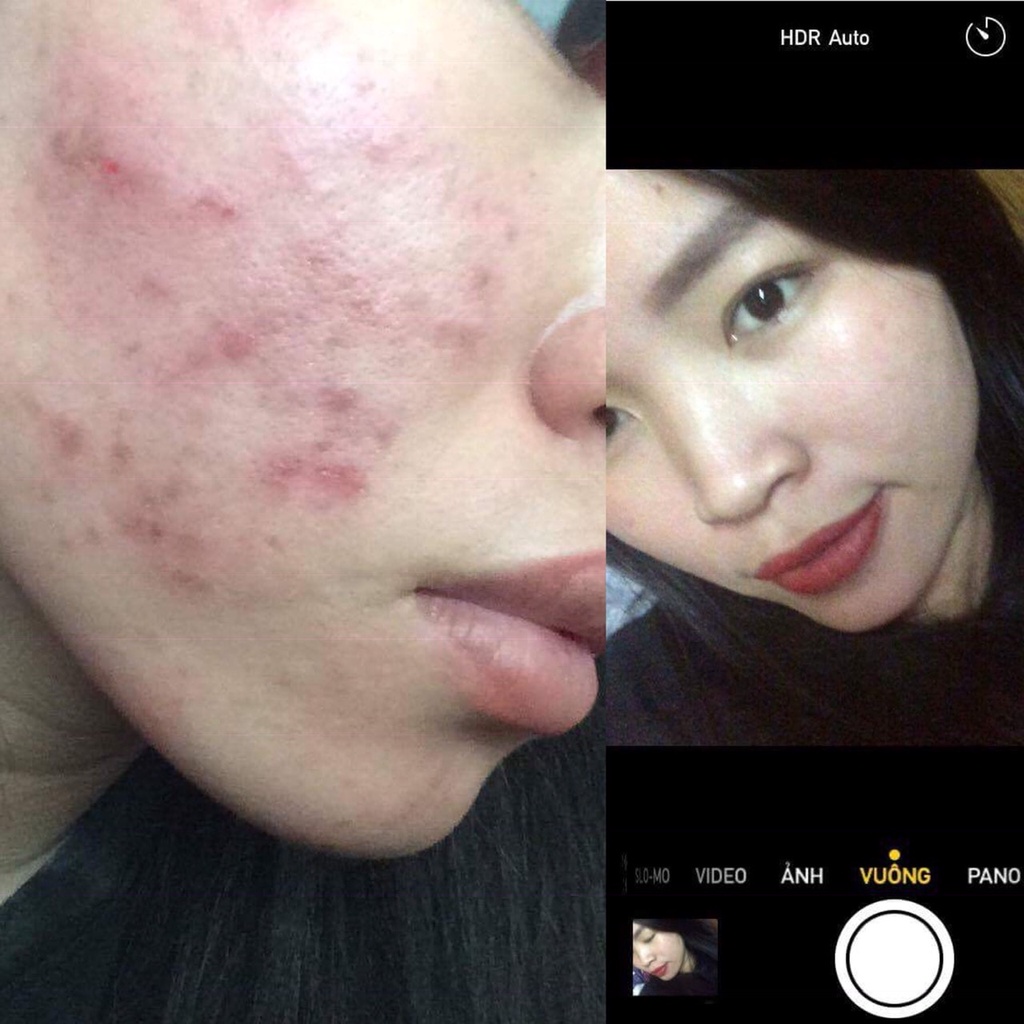 Thảo dược gia truyền tái tạo da 💗Tái tạo da Toner Organic 125ml