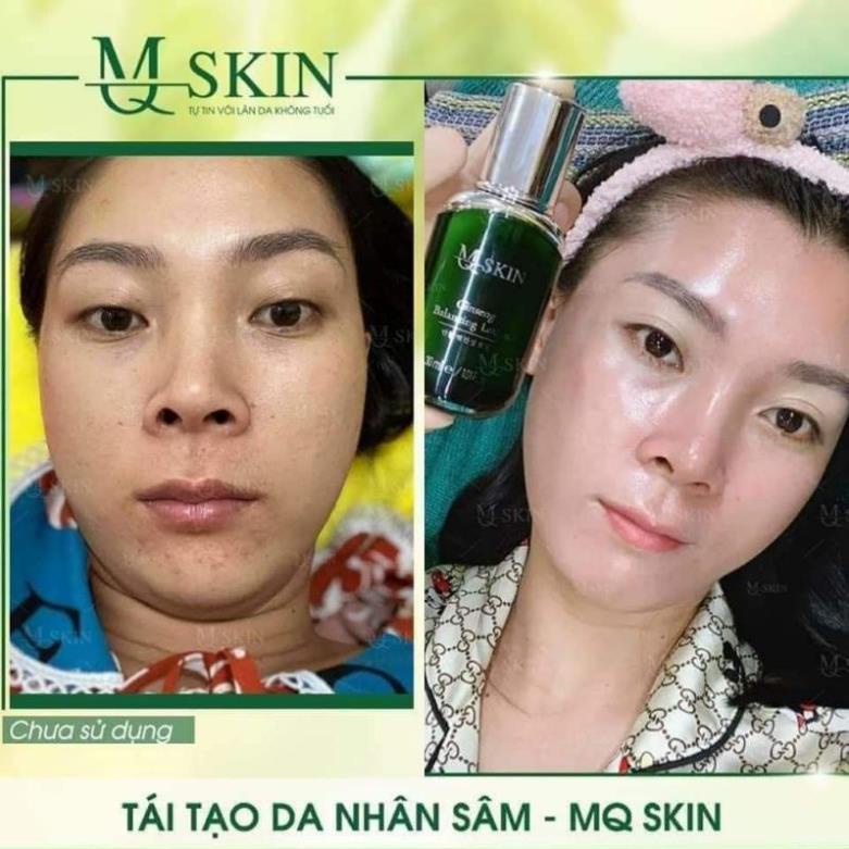 Tái Tạo Da BB Cream MQSKIN Chính Hãng