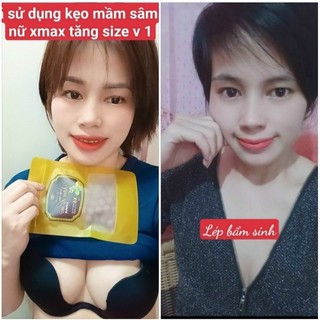 Combo 5h Kẹo Mầm Sâm Tố Nữ Xmax