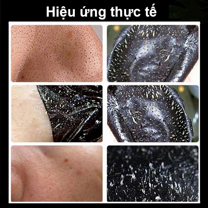 Mặt nạ mụn đầu đen, gel mụn đầu đen, mặt nạ làm sạch, làm săn chắc da, làm trắng da