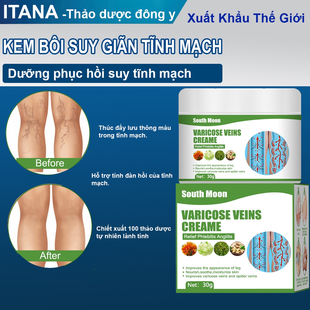 Kem Giãn Tĩnh Mạch Chân Đông Y Thảo Dược Lưu Thông Máu Phục Hồi Giãn tĩnh mạch -30gr