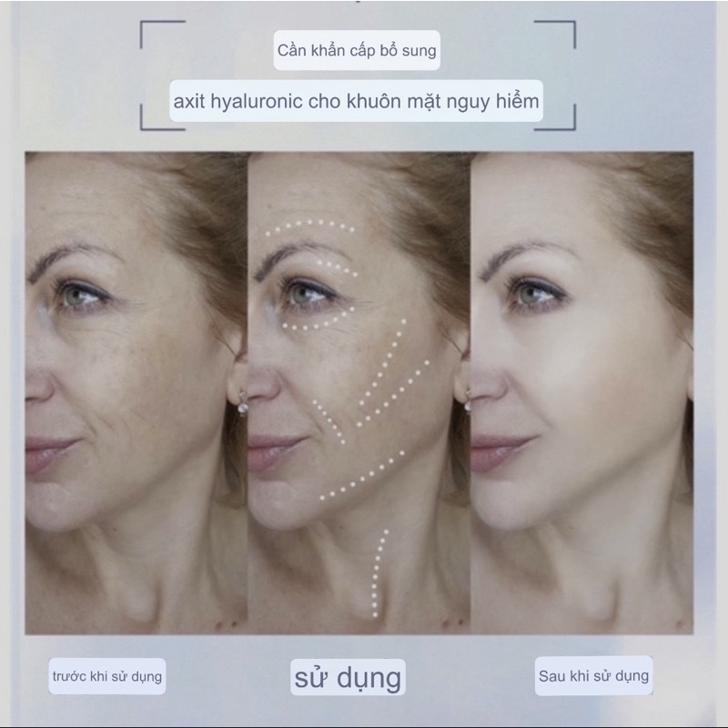 Nước uống Collagen trắng da Sheyan - 1 hộp 8 gói