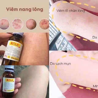 🌸🌱☘️ KELA LOTION THÁI LAN 🌸🌱☘️