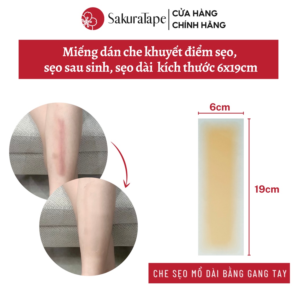 Miếng dán che sẹo dài SakuraTape cỡ 6x19cm che sẹo phẫu thuật, sẹo mổ sinh, chống nước, nhiều màu da
