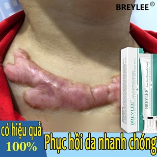 Kem mờ sẹo breylee kem xoá sẹo lồi lõm rỗ mờ thâm mụn rạn da ngừa mụn Sẹo Phẫu thuật Scar/Tấm Dán Mờ Sẹo Lồi/Sẹo Thâm