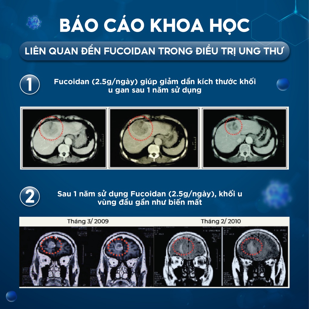 Viên Uống Tăng Đề Kháng Okinawa Kassou Fucoidan GENKI FAMI Giúp Ngăn Ngừa Oxi Hóa, Bảo Vệ Sức Khỏe Hộp 1 Lọ 150 Viên