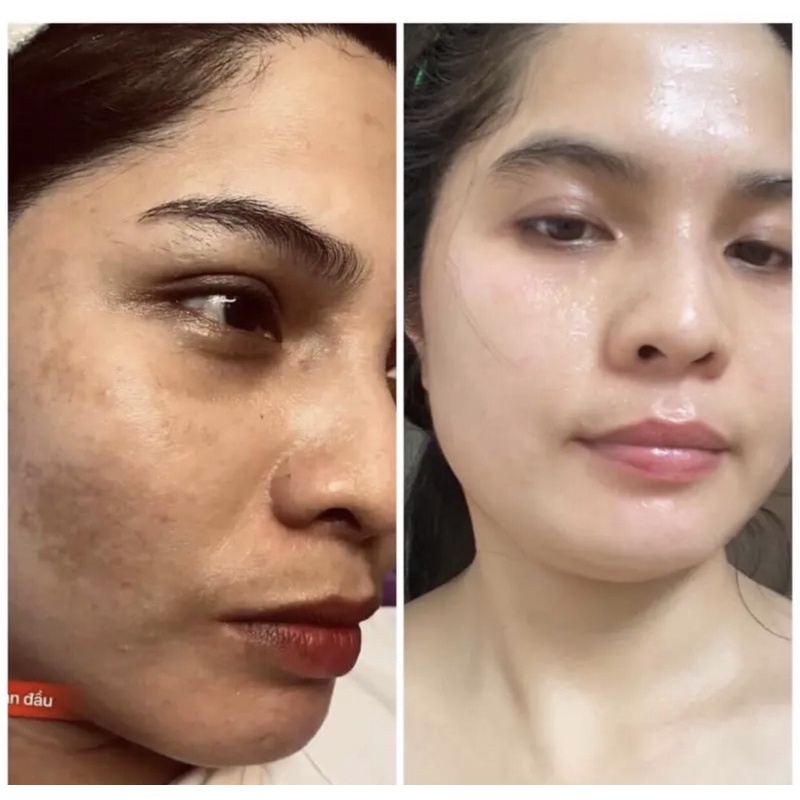 Hộp Huna Royal White trắng da mờ nám, ổn định nội tiết, chống lão hoá da