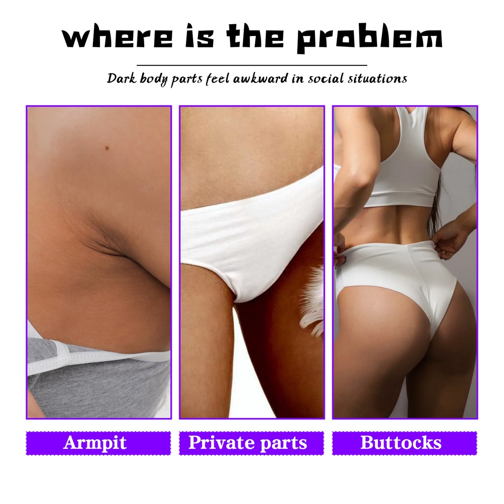 Kem làm trắng vùng kín / làm trắng vùng háng 60ml