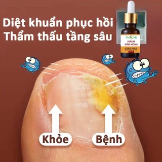Serum nấm móng tay chân
