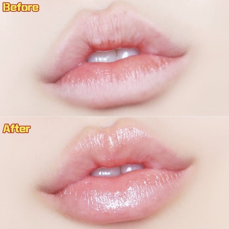 Son Dưỡng Môi Mediheal Labocare Pantenolips 10ml