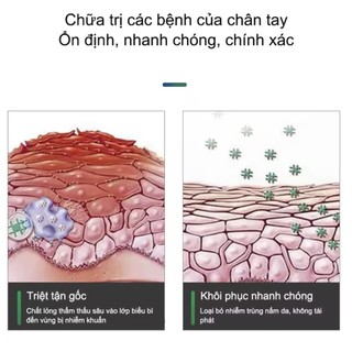 SERUM NẤM MONG TAY CHÂN