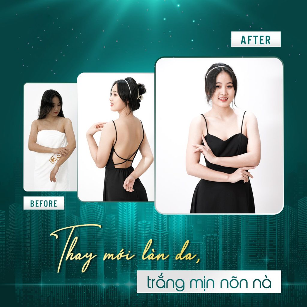 Tắm trắng body cấp tốc HunMui 300ml mặt nạ bùn ủ trắng cơ thể sản phẩm giúp Trắng da siêu nhanh một cách tự nhiên