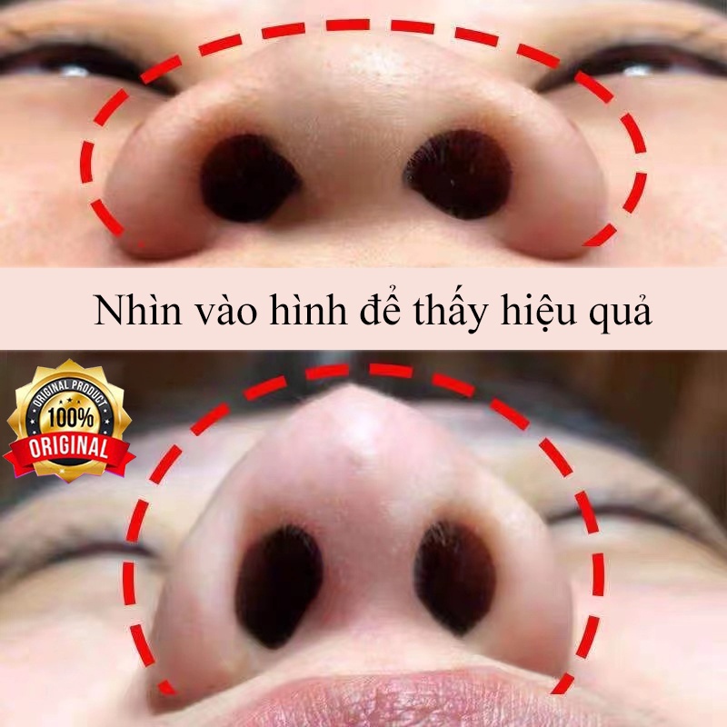 Serum cao mũi 10ml tinh dầu nâng mũi săn chắc tạo dáng mũi tăng chiều cao sống mũi 100%
