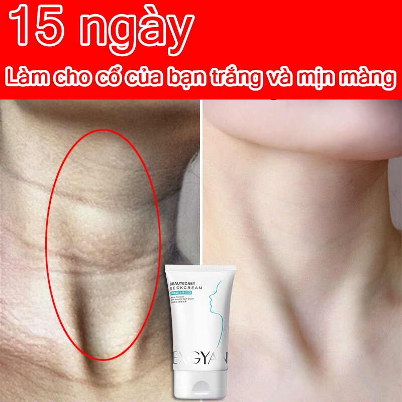Kem Săn Chắc Vùng Cổ chống nhăn làm đẹp da cổ làm mờ vết nhăn cổ Dưỡng ẩm và làm trắng da cổ 110g