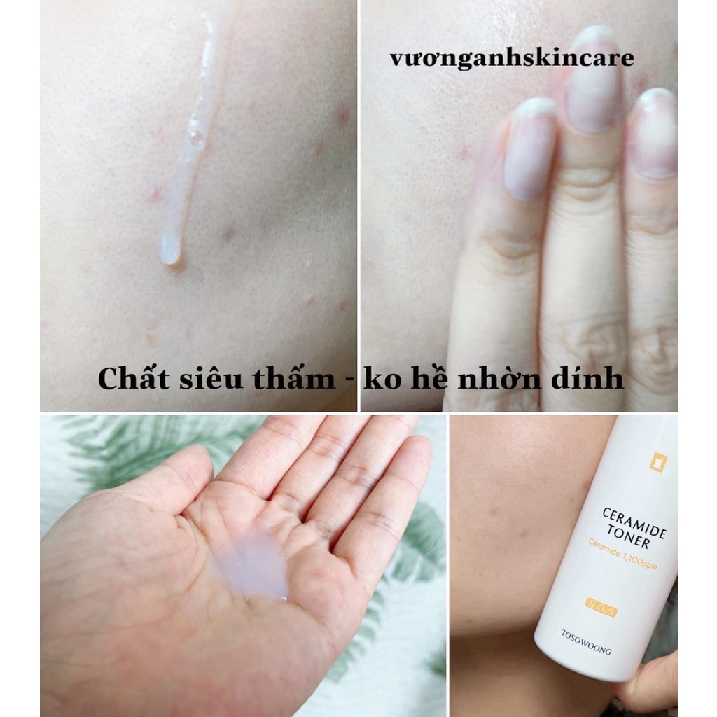 Toner LIPID béo 150ML - TOSOWOONG