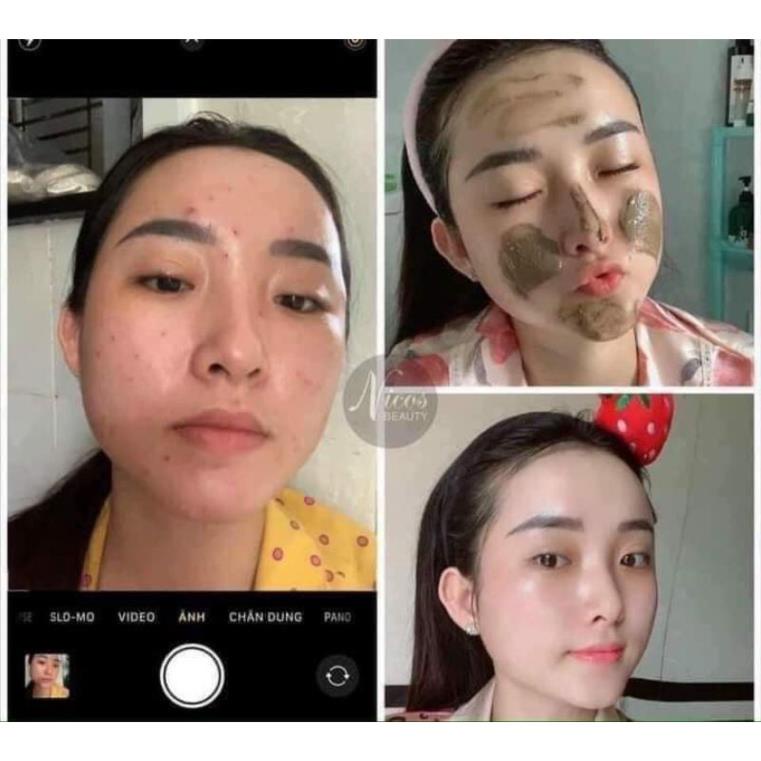 Sữa Rửa Mặt Đông Y Nicos Chính Hãng