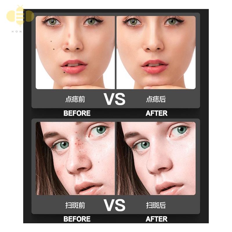 ✔✤●HÀNG CÓ SẴN  Máy xóa vết thâm trên da mặt LCD 9 cấp Xóa nốt ruồi Xóa hình xăm Laser Plasma Pen Máy trị