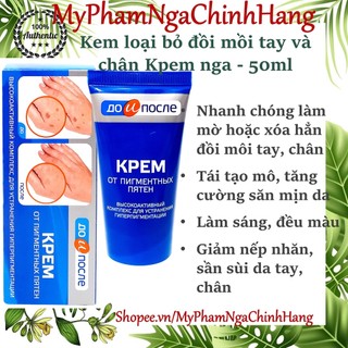 Kem chống đồi mồi Nga - Kem loại bỏ đồi mồi, đốm nâu Kpem