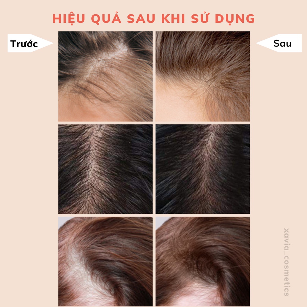 Serum kích mọc tóc MAIGOOLE 60ml kích thích mọc tóc, ngăn ngừa gãy rụng